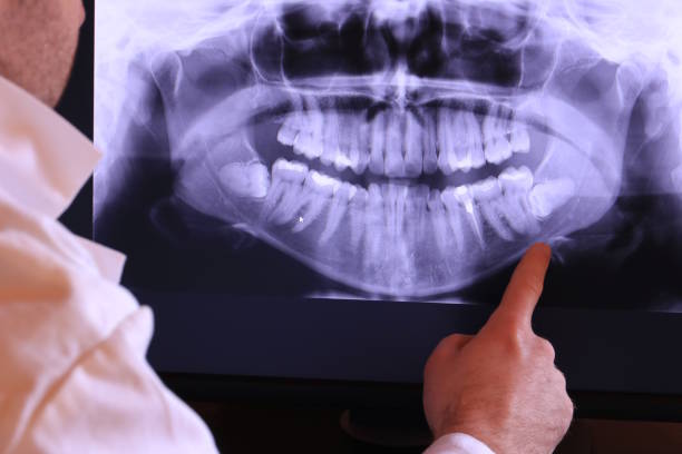 Best Emergency Tooth Extraction  in Ladue, MO